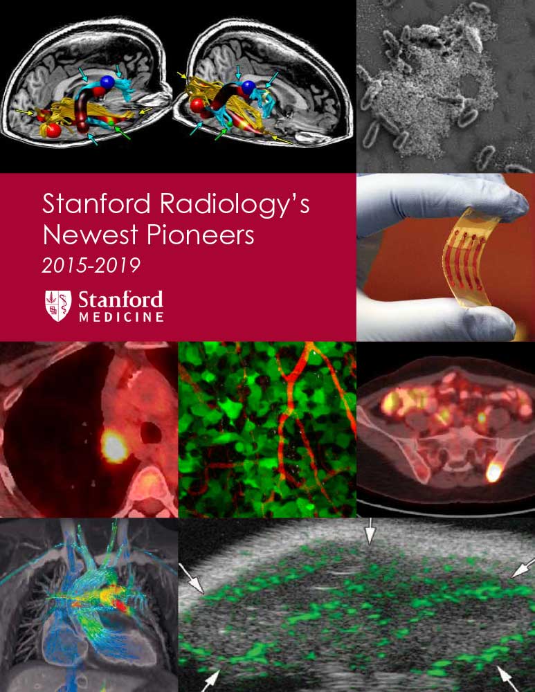 Cover of the Stanford Radiology's Newest Pioneers brochure