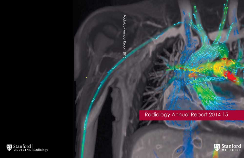 Stanford Radiology Department Report 2014-2015